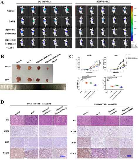 Tumor Associated Macrophages In Direct Contact With Prostate Cancer