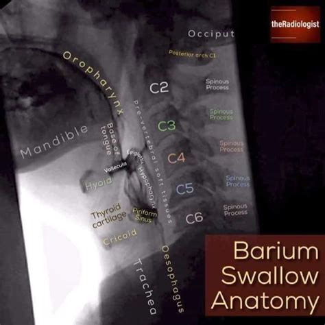 Pin By Donna Baker On Anatomy Barium Swallow Radiology Imaging