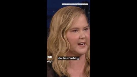 Amy Schumer Reveals She Has Cushing Syndrome The Chronicle