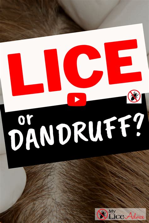 Head Lice Nits Vs Dandruff