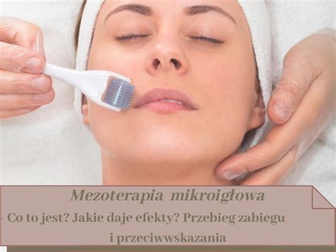 Mezoterapia Mikroig Owa Stylowy Zak Tek Salon Kosmetyczny