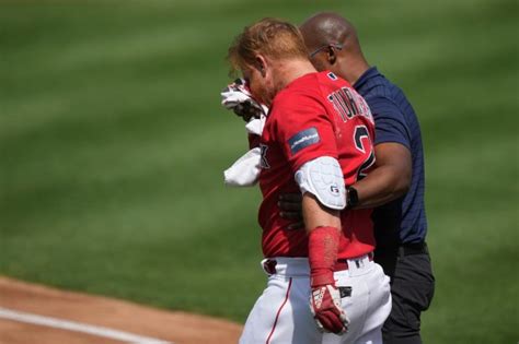 Red Sox Infielder Justin Turner Hit In Face By Pitch Twin Cities