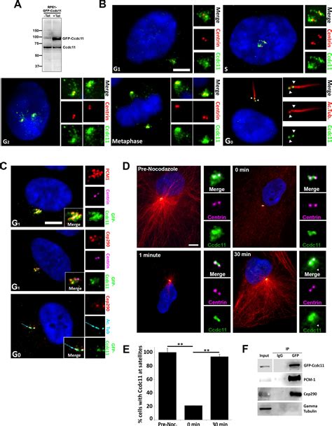 Ccdc11 Is A Novel Centriolar Satellite Protein Essential For