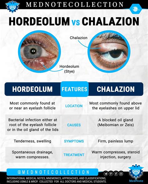 Hordeolum Vs Chalazion Anatomia Y Fisiologia Humana Fisiología