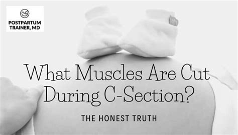 How Many Layers Are Cut During A C Section The Honest Truth