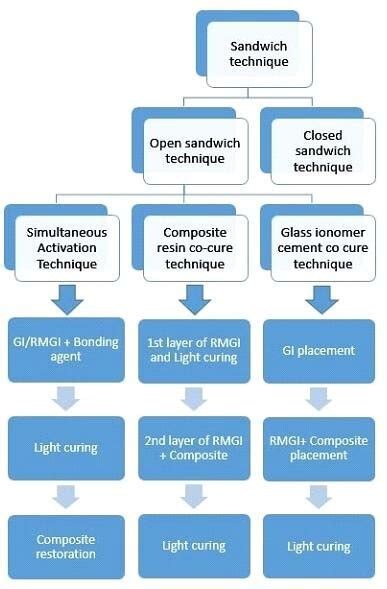 Modifications and Variations of Sandwich Technique | Download ...