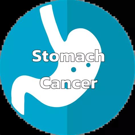 Stomach Cancer: Signs, Causes, Stages, Treatment