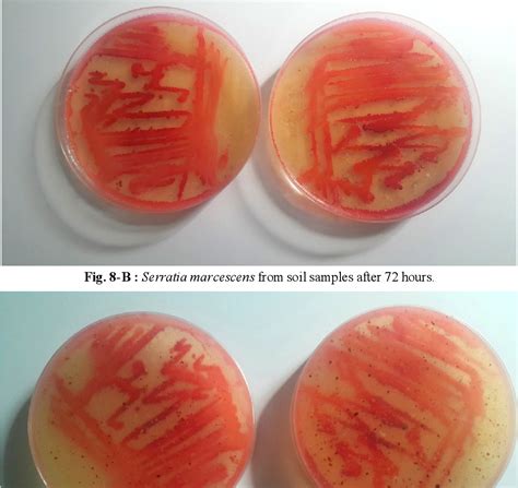 Figure 8 From LOCAL CULTURE MEDIUM FROM THE LEGUMES MIXTURE AS A NOVEL