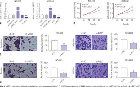 Table From Meg Lncrna From Exosomes Released From Cancer Associated