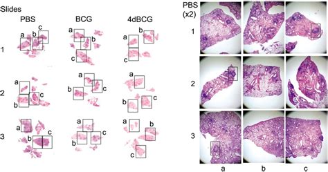 Low Power Photomicrographs Of Sections Of Lung Tissue Upper Left