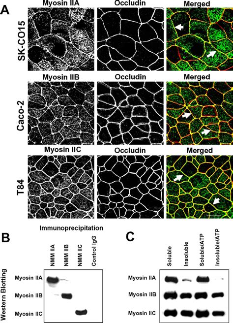 Localization And Biochemical Properties Of Different Nmmii Isoforms In