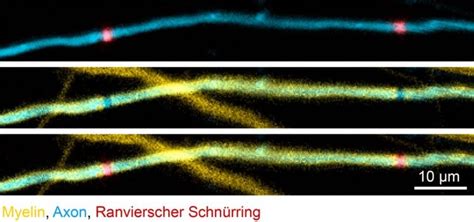 Watching Myelin Patterns Form - Neuroscience News