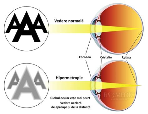 La Ce Varsta Se Defineste Culoarea Ochilor La Bebelusi Culoare Blog