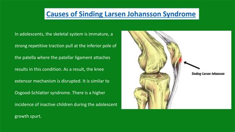 PPT Sinding Larsen Johansson Syndrome Physiotherapy Pain Free