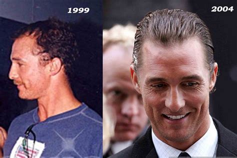 Matthew McConaughey Hair Loss Secrets Revealed!