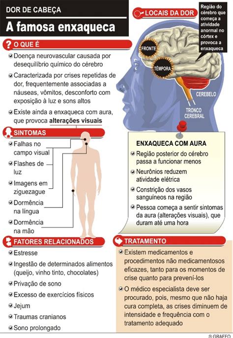 Formas De Enxaqueca Fernando Bragan A Pediatria E Homeopatia