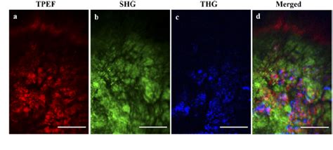 Figure From Miniaturized Multimodal Multiphoton Microscope For