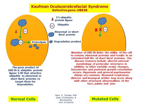 Kaufman Oculocerebrofacial Syndrome Hereditary Ocular Diseases