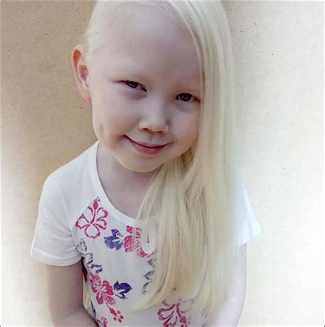 Albino girl known as Snow White becomes as internet sensation in Siberia