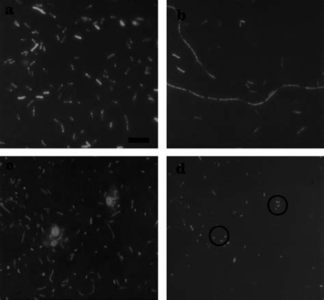 Epifluorescence Micrographs A Bacteria Hybridizing With Probe Bet