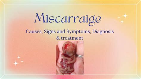 Miscarriage Causes Signs And Symptoms Diagnosis And Treatment Youtube