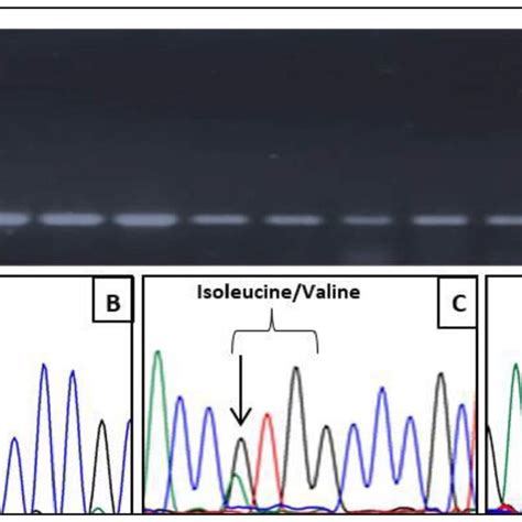 Determination Of CYP1A1 Rs1048943 Genotypes By Direct Sequencing A