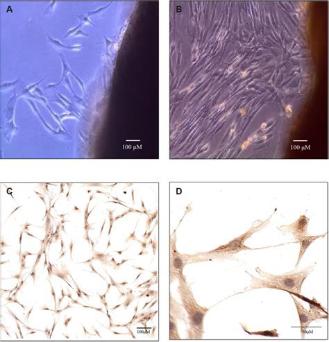 Neuromedin B Receptor Mediates Neuromedin B Induced Cox 2 And Il 6