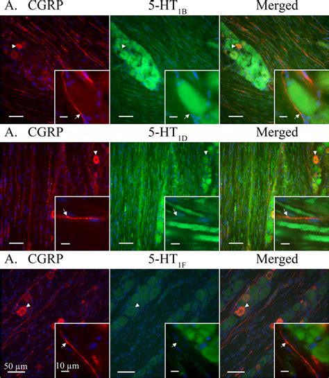 5 Ht1bdf Receptors Co Staining With Cgrp Cgrp Ir Revealed A