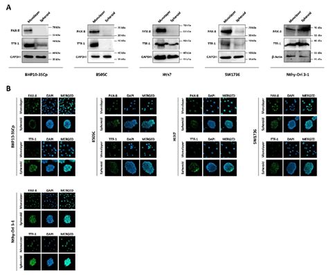 Monitoring Of Thyroid Transcription Factors PAX 8 TTF 1 Under The 2D