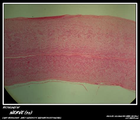 Histology: Nerve Fibers - My Aimst University Lifestyle Blog