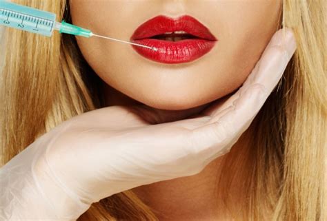 Preenchimento Labial Cirurgião Plástico Esclarece Dúvidas Revista