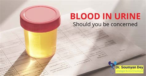 Blood In Urine Hematuria Know The Causes Solutions