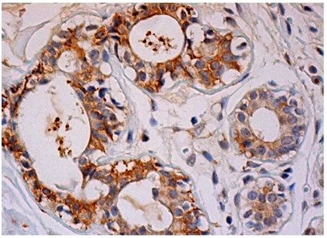 Anti Histone Deacetylase 4 HDAC4 Antibody D 1 SCBT Santa Cruz