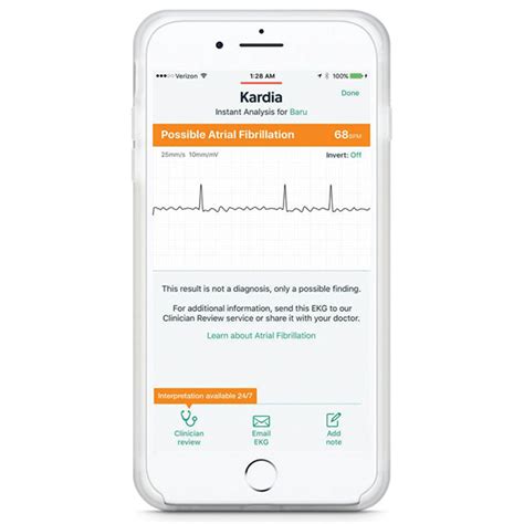 Health Tech | AliveCor's Kardia Mobile App - American College of Cardiology