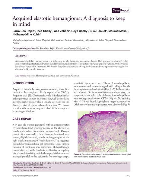 Pdf Acquired Elastotic Hemangioma A Diagnosis To Keep In Mind