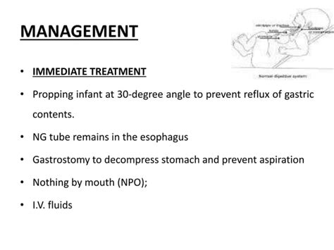 Tracheoesophageal Fistula Ppt