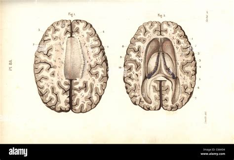 Corte Transversal Del Cerebro Fotografías E Imágenes De Alta Resolución