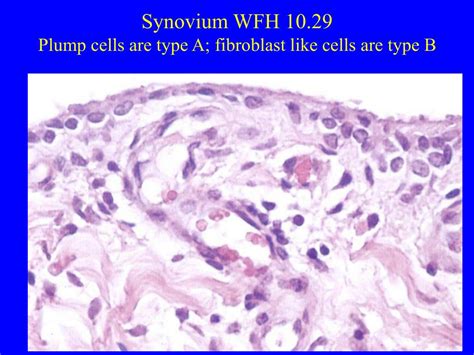 Ppt Synovium Non Synovial Joints And Bone Physiology And Diseases Powerpoint Presentation