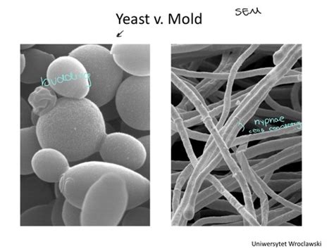 25 - Fungal I Flashcards | Quizlet