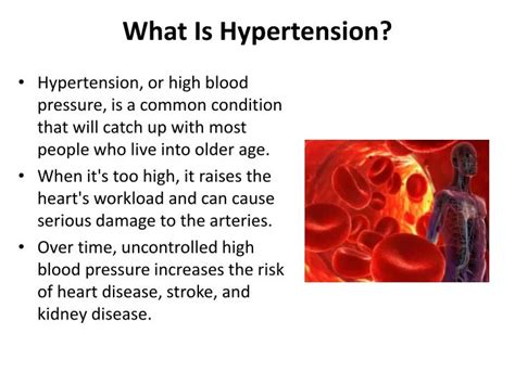 Ppt What Is Hypertension Powerpoint Presentation Free Download Id