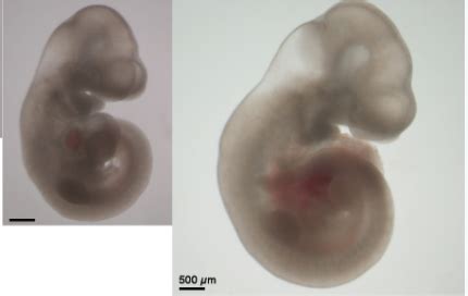 In Breakthrough Israelis Grow Hundreds Of Mouse Embryos In Artificial