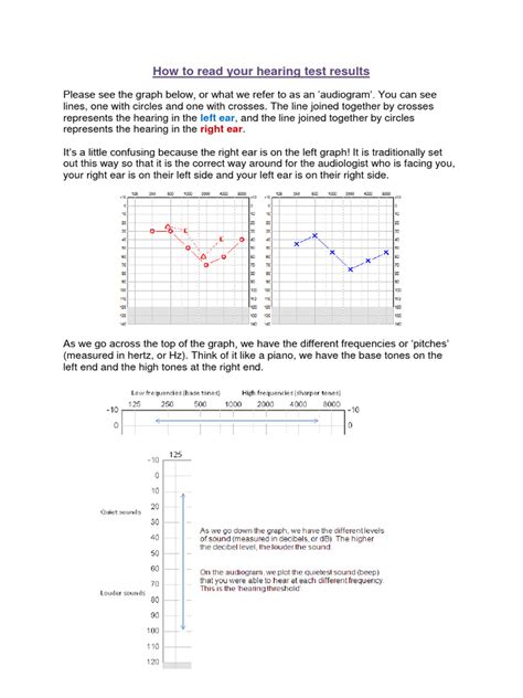 How To Read Your Hearing Test Results | PDF | Hearing Loss | Pitch (Music)