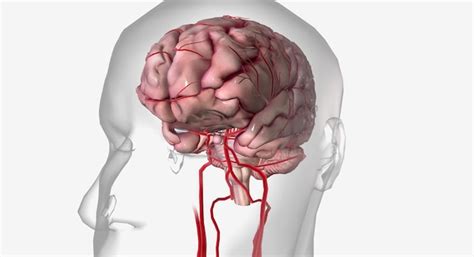 Premium Photo | A transient ischemic attack is a mini stroke with similar symptoms to an ...