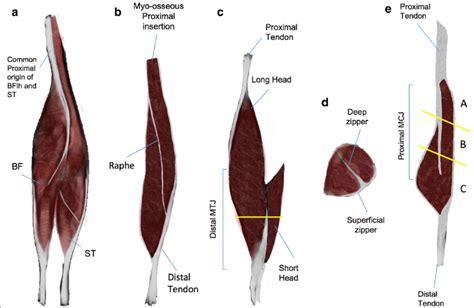 Hamstring Complex Muscles Showing The Distribution Of Connective Tissue