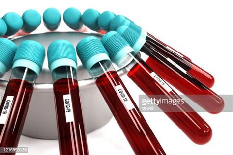 Blood Draw Vials Photos and Premium High Res Pictures - Getty Images