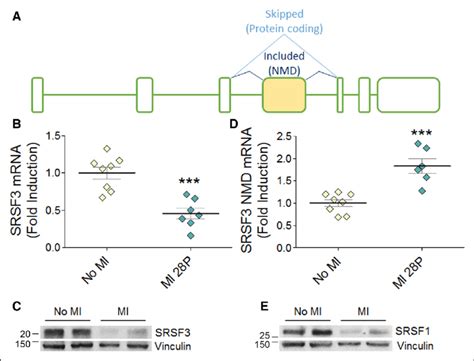 Srsf Serine Arginine Splicing Factor Is Downregulated After