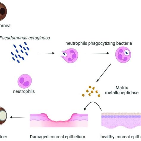 Pdf The Role Of Pseudomonas Aeruginosa In The Pathogenesis Of Corneal