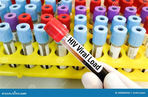 Blood Sample For Hiv Viral Load Test Stock Photo Image Of Pregn