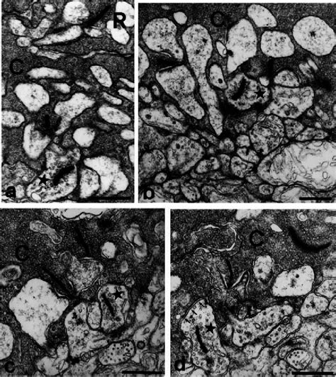 Electron Micrographs Of Synaptic Ribbons Srs At Unusual Sites In The