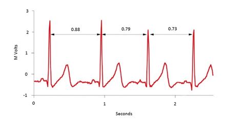 Heart Rate Variability Hrv Athletic Training Institute